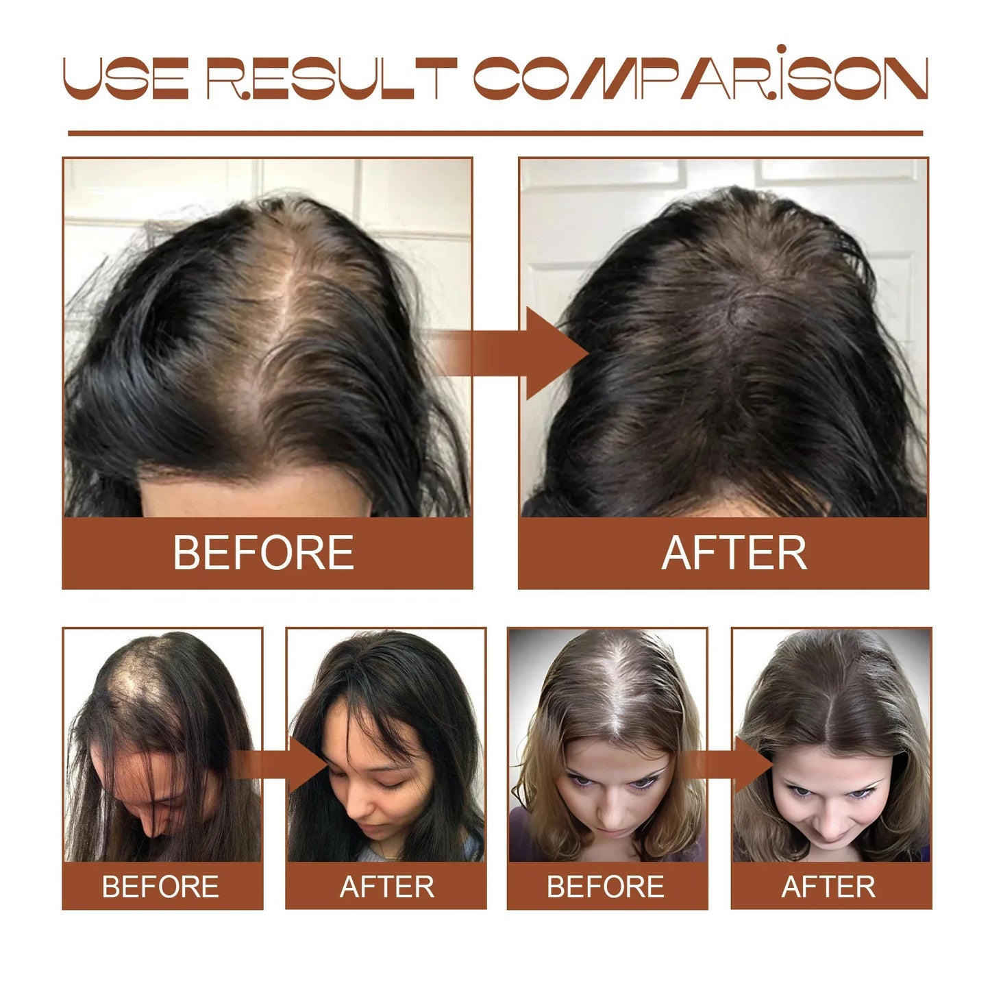 Batana Hair Growth Oil Conditioner anti Hair Loss Products Fast Growing Hair Mask Nourishing Repair Roots Hair Care for Women